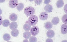 Micrograph of Malaria in Human Cells